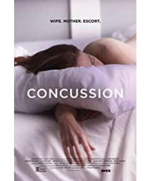 Concussion